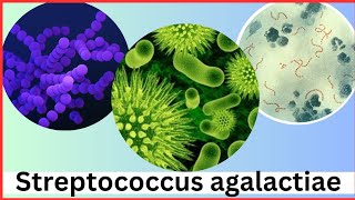 Streptococcus microbiology  Streptococcus agalactiae [upl. by Adlihtam]