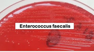 Enterococcus faecalis Colony Morphology on CLED Agar [upl. by Apicella568]