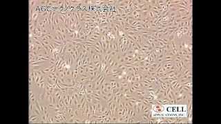 Human Umbilical Vein Endothelial Cells HUVEC [upl. by Alie]