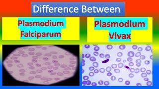 Distinction Between Plasmodium Falciparum and Plasmodium Vivax [upl. by Audy836]