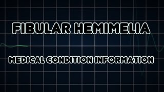 Fibular hemimelia Medical Condition [upl. by Inek491]