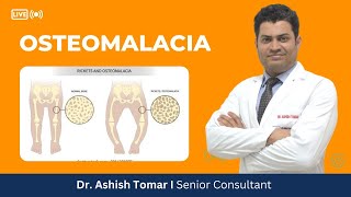 Everything about Osteomalacia I Dr Ashish Tomar [upl. by Shermy737]