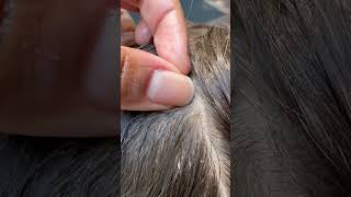 Picking Lice l Lice Removal l Small Business explore hair backtoschool [upl. by Acila381]