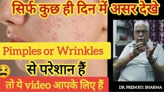 Pimples Or Wrinkles से परेशान हैं तो ये Video आपके लिए हैं सिर्फ कुछ ही दिन में असर देखे [upl. by Ivgnout]