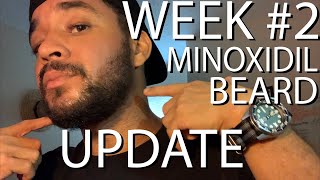 My Minoxidil Beard Update  WEEK 2 New growth [upl. by Malissia]