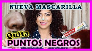 INCREIBLE 🔴 Quitar Puntos Negros con COLGATE Y VASELINA  ✅ FUNCIONA 😱 [upl. by Eirak]