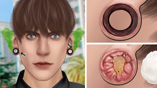 ASMR Treatment and cleaning of large swollen and smelly ear piercings  부풀어 오른 피어싱 구멍을 고름으로 청소하십시오 [upl. by Anaitat]