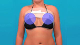 Using a Bandeau After Breast Augmentation  DFW Plastic Surgeon Dr Michael Bogdan [upl. by Leira]