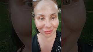 22072024 No filters No makeup No BotoxJust natural fat lipophilicity365days reality nobotox [upl. by Schoenburg]