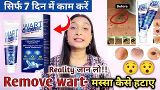 Wart Remover creamwart remover ointment Meesho instant Blemish Removalमस्सा कैसे हटाए2023 [upl. by Nedak]