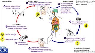 Leishmaniasis anthroponotic life cycle [upl. by Maximilianus]