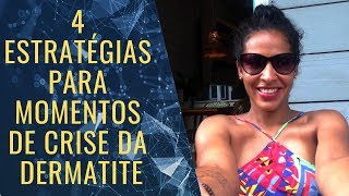 4 Estratégias para momentos de CRISE da dermatite [upl. by Valera52]