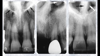 Intraoral Anatomy Review [upl. by Marwin]