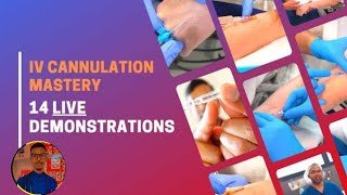 IV CANNULATION MASTERY  14 LIVE DEMONSTRATION [upl. by Oniotna]