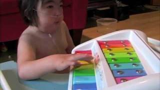 Mieko plays piano Trisomy 18 [upl. by Yeniffit567]