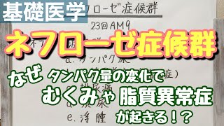 【解説】ネフローゼ症候群の発生機序まるわかり！ [upl. by Hctim]