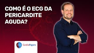 ECG entenda as alterações da pericardite aguda [upl. by Boeschen]