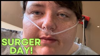 Gastric sleeve  surgery day [upl. by Akir]