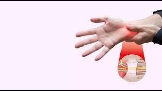 7 Exercises to HEAL Carpal Tunnel FAST Try These NOW [upl. by Hunfredo758]