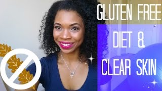 Acne and Diet Part 2 Gluten [upl. by Aisemaj961]