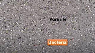 Bacteria and Parasites in stool Microscopy Live motile bacteria and cysts of Giardia lamblia [upl. by Ahsoyem]