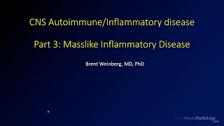 Imaging CNS autoimmune and inflammatory disease – Part 3  Masslike inflammatory disease [upl. by Eytak754]