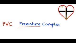 Premature Ventricular Contractions PVC Interpretation Easy and Simple [upl. by Bonn]