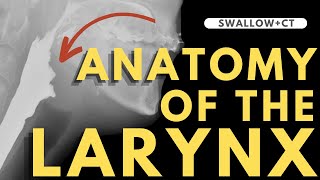 Larynx Anatomy  Radiology anatomy part 1 prep  CT interpretation [upl. by Ennaid]