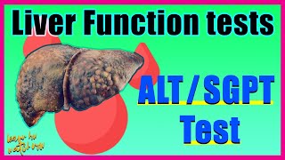 Alanine aminotransferase ALT test SGPT Alt test Results amp Interpretation  Liver function test [upl. by Salena905]