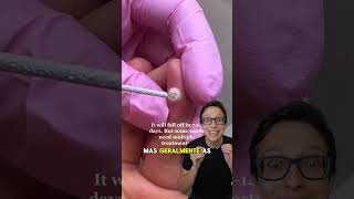 HPV parte 2 😱❄️ medicina medico enfermeiro enfermagem enfermeira dermatologia dermatologo [upl. by Tracey]