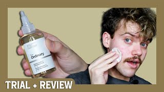 the ordinary glycolic acid 7 exfoliating toner  trial  review [upl. by Ridglea]