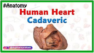 Human Heart Cadaveric Anatomy Clinical Application Apex Base Pulmonary sinuses Coronary sulcus [upl. by Anaele]