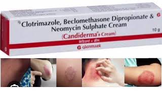 Candiderma  Cream Clotrimazole Beclomethasone Dipropionate amp GNeomycin Sulphate Cream [upl. by Idalla]