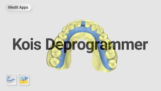 Designing a Kois Deprogrammer with the Medit Splints amp Design App [upl. by Roos]