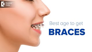 What is the IDEAL AGE FOR BRACES  Redesign your Smile  Dr Deepa Jayashankar  Doctors Circle [upl. by Ahserkal372]