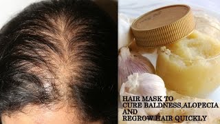 GINGER HAIR MASK FOR EXTREME HAIR GROWTH  HOW TO GET LONG HAIRSOFT HAIRSMOOTH HAIRTHICK HAIR [upl. by Assyla]