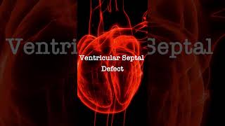 Normal Heart Sounds vs Ventricular Septal Defect Murmur [upl. by Ailliw367]