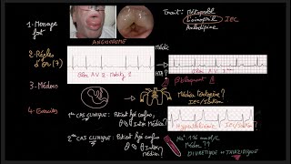 Traitement de lhypertension artérielle  Guidelines  Exercices  HTA  Docteur Synapse [upl. by Charmane895]