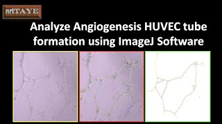 How to analyze Angiogenesis HUVEC cell tube formation assay using ImageJ Software [upl. by Davina]