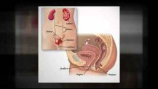 Urinary Tract Infection Symptoms [upl. by Ingra]