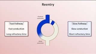 Intro to EKG Interpretation  Mechanisms of Tachyarrhythmias [upl. by Yar557]