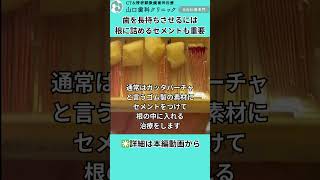 根の中に詰めるセメントも重要 根管治療 歯が割れる 虫歯 恵比寿 歯医者 [upl. by Kingsbury]