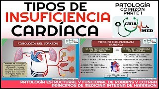 INSUFICIENCIA CARDÍACA DERECHA E IZQUIERDA FISIOPATOLOGÍA  GuiaMed [upl. by Trepur]