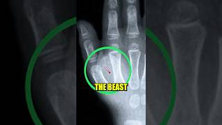 The UNTOLD Truth About The Mark Of The Beast bible bibleexplained ytviral [upl. by Ecirum979]