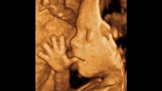 3D fetal ultrasound  amazing things fetuses do in the womb  Dr I Shapiro [upl. by Trever26]