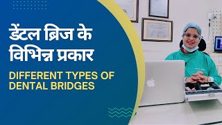 Dental Bridge  Different Types of Dental Bridges  डेंटल ब्रिज के विभिन्न प्रकार [upl. by Hairakcaz]