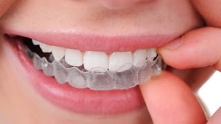 Ortodoncia invisible Inicia INVISALIGN [upl. by Chevy]