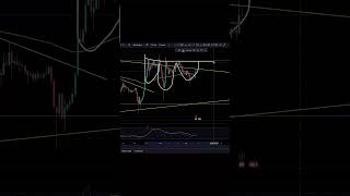 XRP Everything Looking EXTREMELY Overextended Bounce Soon xrpnews xrpripple [upl. by Eerahc267]