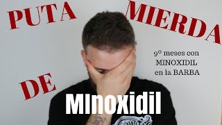 9º Meses con MINOXIDIL PUTA MIERDA DE MINOXIDIL [upl. by Adnarahs]