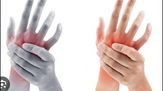 Acupressure points for hands numbness fingers Elbows shoulder nerve compression injury pain [upl. by Rooke]